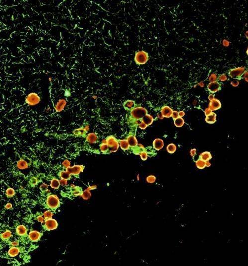 파킨슨병 환자 뇌의 변형 녹말 양소체 파킨슨병은 중뇌 흑질의 도파민 분비 뉴런이 사멸해 생기는 신경 퇴행 질환이다.
그런데 파킨슨병 환자나 고령자의 뇌에선 변형된 녹말 양소체가 많이 발견된다.
정상 구조의 녹말 양소체는 뇌의 폐기물 용기로 쓰인다.
[스페인 바르셀로나대 제공 / 재판매 및 DB 금지]