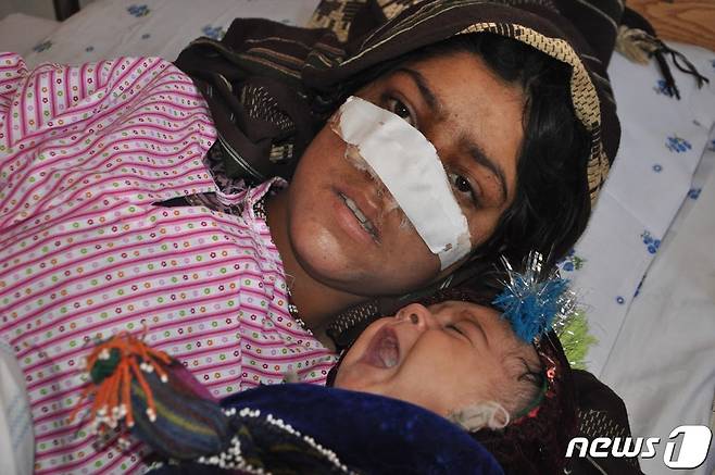 아프가니스탄 한 여성이 남편에 의해 코가 잘려 붕대를 감은 채 아이와 누워있다. (본문과 관련없음) 2016.01.19 © AFP=뉴스1