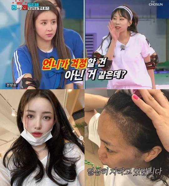 In the past, molding was seen as a secret, or uncomfortable, suspicion that should never be seen by Celebrity.Now, as the number of Celebrities who self-expose their molding facts increases, they are getting favorable with honest and cool attitude.Singer Eun Ga-eun, who became popular as a TV ship Miss Mr. Trot2, appeared on Wife Card Writing Man broadcast on September 21, saying, It is not all my eyes.Kim, who is from the same Mr. Trot2, was also noticed early on by the fact that he had a nose molding.Broadcaster Ham So-won recently went on a live SNS broadcast with sunglasses on after receiving double eyelid surgery, and actor Lee Sang-a also said that he had brightened plastic surgery for correcting his eyes through SNS.The YouTuber Yu Se-leaf, which appeared on TV Chosun We Divorced, also made face fat transplants and breast molding Confessions and spread various portal site entertainment news bulletin boards.Not only plastic surgery, but also unprecedented hair loss Confessions attract attention.Actor Ko Eun-a, who had been worried about hair loss, revealed the procedure on the 28th that he planted about 3,000 hair through YouTube channel Bangane.In the past, when Celebrity was surrounded by a controversy over molding, it was 180 degrees different from what they said was just correcting teeth or taking out flesh.In the background of change, it is presumed that the publics gaze, which wants honesty rather than perfection, influenced Celebrity.It is now natural for the public to support the subtitle Courageful Confessions or to support it.It is not necessary to make the molding Confessions a wonderful thing, but it is evaluated as a positive change in that the atmosphere of turbulence of molding, which is only an individual choice, has been resolved.As honest Confessions emerged as a trend, Celebrity gained more free communication and the public gained intimacy and empathy.It is noteworthy how colorful changes and growth will be in the entertainment industry climate now that the Confessions gusts such as open love and divorce are gradually growing beyond molding.