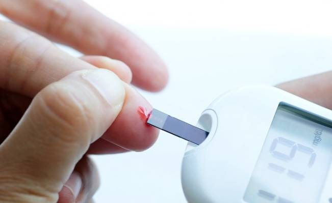 코로나19 바이러스가 인슐린을 만드는 장기인 췌장세포를 공격해 코로나19 감염 중 또는 완치한 뒤 일부가 당뇨병에 걸릴 위험이 높다는 연구 결과가 나왔다. 이미 당뇨병을 앓고 있던 환자는 코로나19 감염 후 심각한 합병증이 생길 위험이 높다는 것이다. 게티이미지뱅크 제공