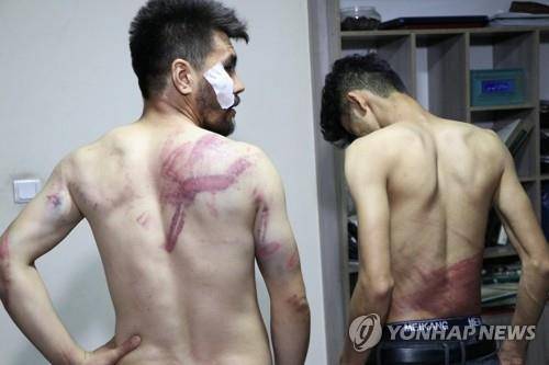 탈레반에 폭행당한 상처 보여주는 아프간 기자들. [연합뉴스]
