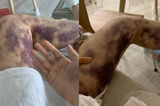 [아옳이 인스타그램 캡처]