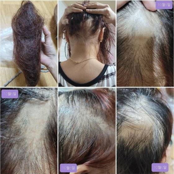 [네이버카페 '코로나 백신부작용 피해자 모임' 캡처]