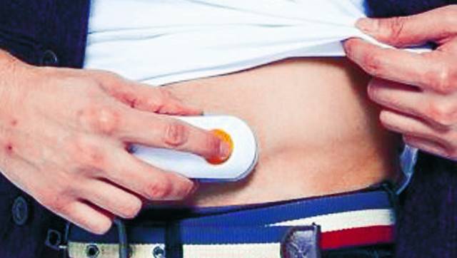 연속혈당측정기는 복부에 부착(아래 사진)하면 5분에 한 번씩 혈당을 자동 측정해 알려 주기 때문에 잠을 자거나 운동 등 일상생활을 하는 데 방해를 덜 받는다. 감지된 혈당 수치는 스마트폰 앱을 통해 실시간 전송돼 혈당 관리에 편리하다. 업체 제공