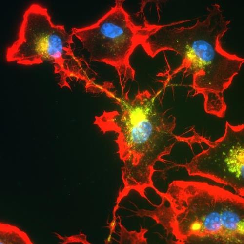 소교세포의 분업 메커니즘 소교세포의 핵(청색)이 튜브형 돌기(적색)로 연결돼 있다.
이런 네트워크는 독성 단백질을 제거하는 분업에 유리하다. 
[본 대학 미하엘 헤네카 교수 / 재판매 및 DB 금지]