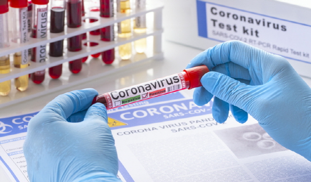 코로나19 항체검사시약을 이용한 면역력 확인은 불가능하다/사진=게티이미지뱅크