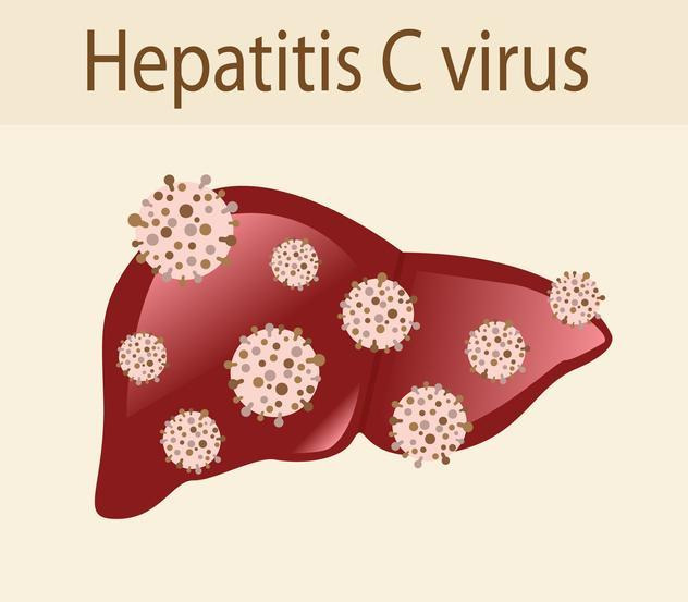 C형 간염은 예방 백신은 없지만 8~12주 치료하면 98% 이상 완치할 수 있는 약이 개발됐다. 게티이미지뱅크