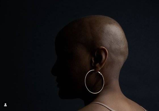 한 번도 가발을 벗고 세상에 나온 적이 없었던 셀람 베다다(35)는 2018년 촬영을 한 뒤 당당하게 가발을 벗고 스튜디오를 나왔다. 인스타그램 캡처