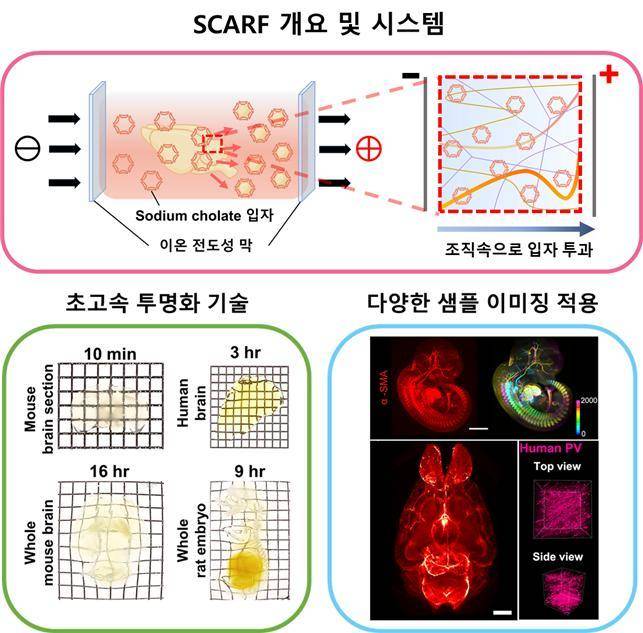 [서울=뉴시스] 연구진은 SC라는 담즙에서 유래된 계면활성제가 조직 투명화에 적합함을 발견했다. SC는 SDS보다 훨씬 작은 입자를 형성해 조직에 깊게 들어갈 수 있으며 지질 제거 능력이 탁월하다. 그러나 SC를 조직 투명화 기술에 사용하면 침전물이 형성되고 조직이 갈색으로 변하는 상당히 심각한 문제가 발생했다. 이를 해결하기 위해 연구진은 이온 전도성 막과 최적화된 버퍼조건을 확립해 이러한 문제를 해결했다. SCARF는 조직투명화 이후 3차원 조직의 면역항체염색도 더 용이하게 만들어, 차후 임상의 조직진단에도 적용이 가능함을 보였다(자료=서울대 제공) *재판매 및 DB 금지