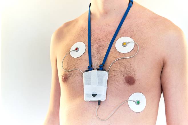 ‘홀터 모니터 검사’(Holter monitoring) 게티이미지뱅크