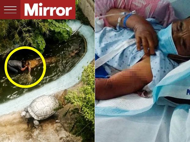 60대 관광객이 악어에게 공격당해 병원에서 치료받는 모습. /영국 '미러' 보도 화면, ViralPress