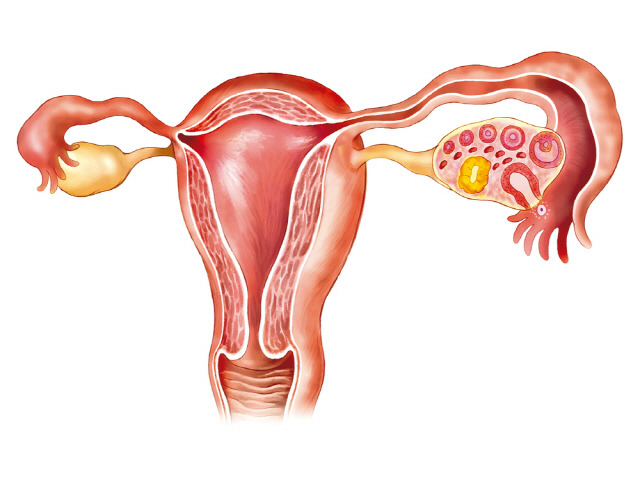 난소에도 혹이 발생할 수 있다./사진=클립아트코리아