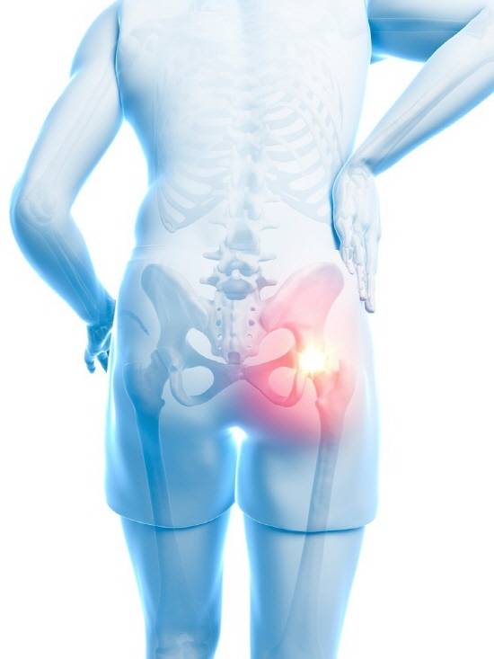 사타구니 부위나 엉덩이, 허벅지 쪽으로 뻗치는 통증이 1~2주 이상 지속한다면 고관절 질환을 의심할 수 있다./클립아트코리아 제공