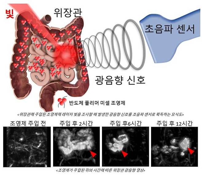 [포항=뉴시스] 강진구 기자 = 포스텍(총장 김무환)은 IT융합공학과·전자전기공학과·기계공학과 김철홍 교수·박별리 박사 연구팀이 중국 톈진대학교 유미아오 장(Yumiao Zhang) 교수·박사과정 위안멍 딩(Yuanmeng Ding) 씨 연구팀과의 공동 연구를 통해 생체의 심부 조직을 고통없이 볼 수 있는 광음향 영상법을 개발했다고 8일 밝혔다.사진은 연구 관련 그림.(사진=포스텍 제공) 2021.12.08.photo@newsis.com *재판매 및 DB 금지