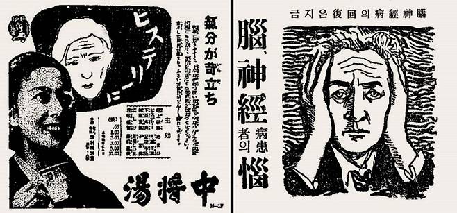 광고 속에서 신경질환은 남성의 질환(오른쪽 사진)으로, 좀 더 부정적 의미인 히스테리는 여성의 질환(왼쪽 사진)으로 묘사되곤 했다. 1933년 10월13일자 <동아일보>에 실린 신경병 광고(오른쪽)와 1939년 5월2일자 <경성일보>에 실린 약 광고(왼쪽). 서해문집 제공.