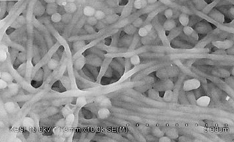 주사전자현미경으로 1만배 확대한 사진. 구강세균이 번식해 바이오필름을 형성한 티타늄 표면.