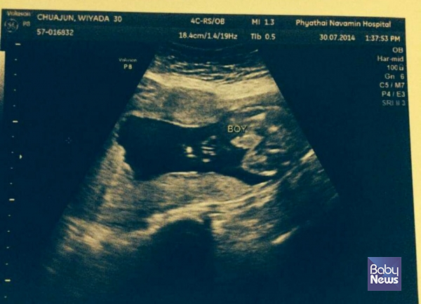 행복이의 초음파 사진. 그는 행복이를 통해 부모의 마음을 이해하게 됐다. ⓒ비렐