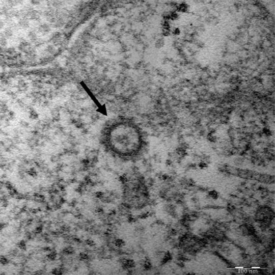 코로나19 바이러스(SARS-CoV-2)의 전자현미경 사진. <질병관리청 제공>