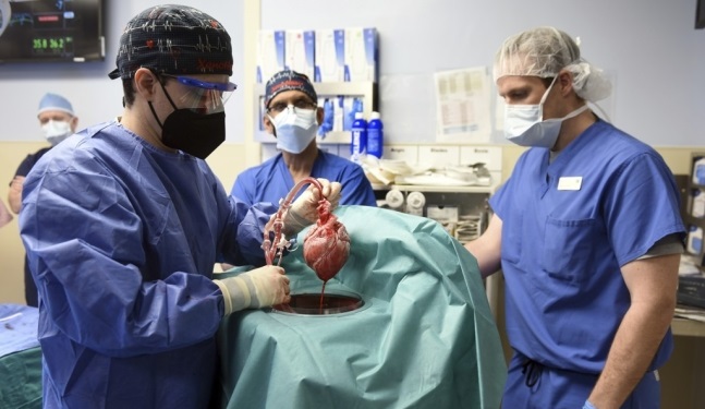 미국 메릴랜드대 의대 연구팀이 지난 7일 이식 수술에 앞서 유전자 조작 돼지 심장을 들어 보이고 있다./메릴랜드 의대 제공