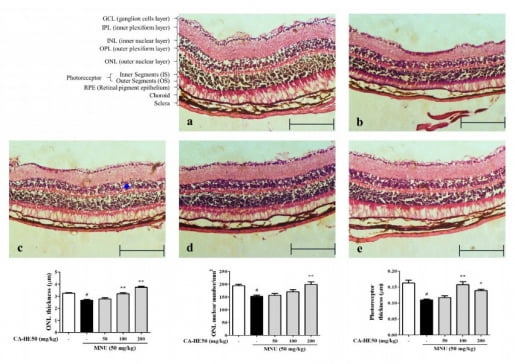 망막조직 내 황반변성이 손상된 쥐에게 병풀추출분말을 투여하고 개선도를 관찰한 실험./자료 제공=제넨셀