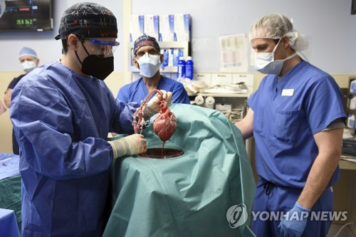 미국 매릴랜드 의과대 연구팀이 지난 7일 세계 최초로 유전자 조작 돼지의 심장을 인간에게 이식하는 수술을 진행하면서 꿈틀대는 돼지의 심장을 들어보이고 있다./사진제공=메릴랜드대 의대