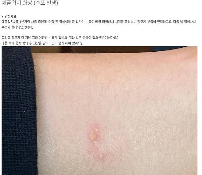 애플 사용자 커뮤니티에 한 이용자가 남긴 글.
