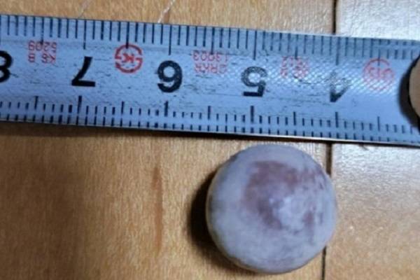 굴찜 먹다 발견한 커다란 진주 / 사진 = 연합뉴스