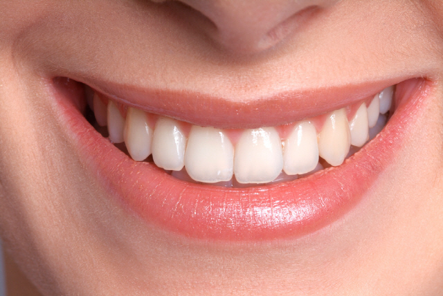 충치가 있을 때 치아 미백을 하면 이 시림 증상이 심해질 수 있다./사진=클립아트코리아