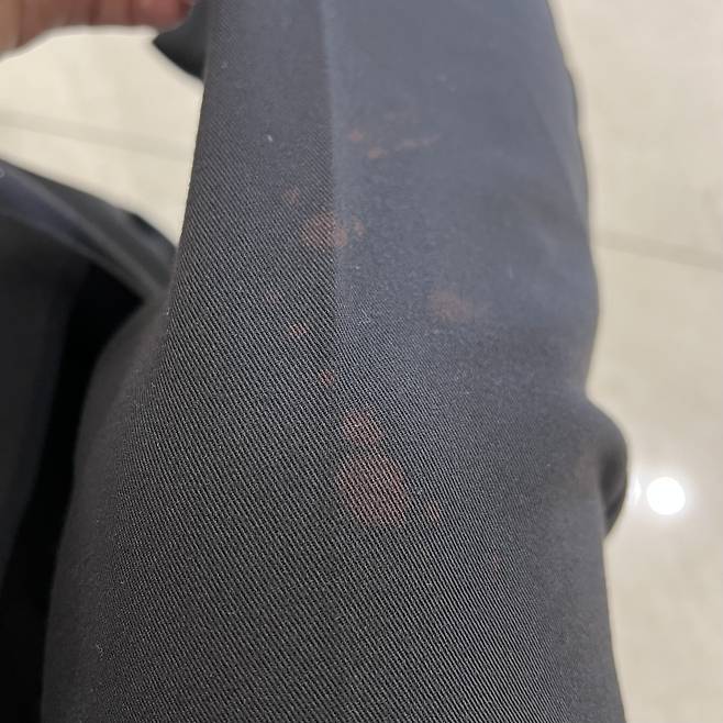 물이 바지에 튀어 탈색된 모습. (온라인 커뮤니티 갈무리) © 뉴스1