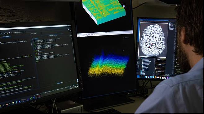 과학자들이 루게릭병 환자의 뇌에서 나오는 전기신호를 분석하고 있다./스위스 비스 센터