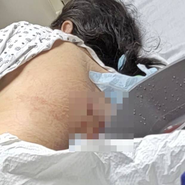 신원 공개를 거부한 피해 여성은 “누군가 뒤에서 갑자기 밀쳐 넘어졌다. 가방을 뺏겼고 칼에 찔렸다”고 밝혔다.
