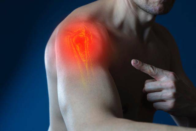 어깨 통증 이미지. 게티이미지뱅크