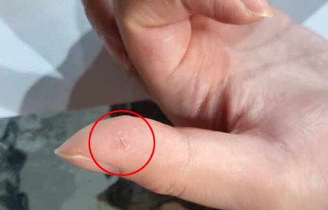 고양이가 할퀴었다고 B씨의 손가락을 보여주는 장면. '전길연' 제공