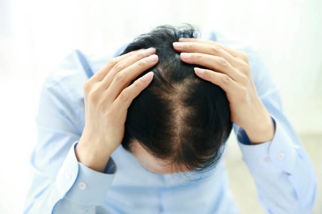 지루성두피염은 완치가 되기보다 만성적으로 재발이 잘 돼, 증상이 심한 사람들은 악화 요인을 피하면서 살아야 한다./클립아트코리아 제공