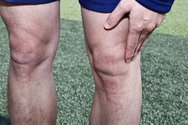 손흥윤 코치의 무릎 부근은 다 까져 있었다. 손 코치는 지시만 하는게 아니라 아이들과 똑같이 훈련한다. 김현동 기자