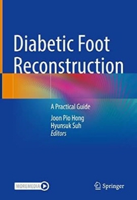 'Diabetic Foot Reconstruction' /서울아산병원 제공