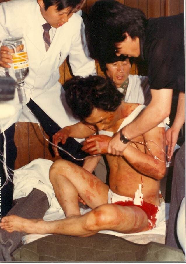 5·18 민주화운동 때 부상을 입고 기독병원으로 이송된 시민을 의료진이 치료하고 있다.