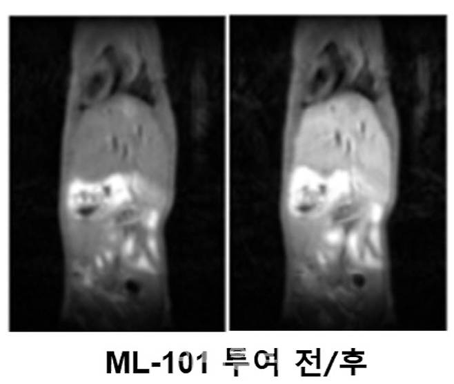 멜라니스의 간질환 동반진단 신약 후보물질을 이용한 마우스의 MRI 간 조영 영상. 멜라니스 ML-101 투약 전 후 사진 비교. 확연한 조영효과를 발견할 수 있다. (제공=비엘팜텍)