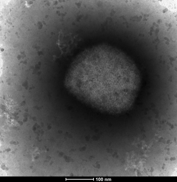 지난 26일 스페인 연구기관이 공개한 '원숭이 두창' 바이러스의 전자 현미경 사진.AP뉴시스