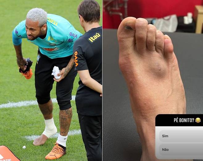 한국전을 앞둔 1일 미니게임 도중 오른발 부상을 당한 네이마르. 오른쪽은 그가 같은 날 올린 사진. /인스타그램