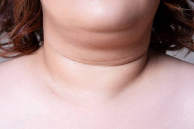 다이어트를 해도 턱살이 빠지지 않는다면 근육 탄력이 떨어졌거나, 자세가 바르지 않거나, 침샘비대증이거나, 무턱이라서 일 수 있다./사진=게티이미지뱅크