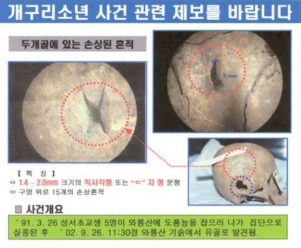 개구리소년 사건 피해 어린이 두개골 사진 [대구 달서경찰서]