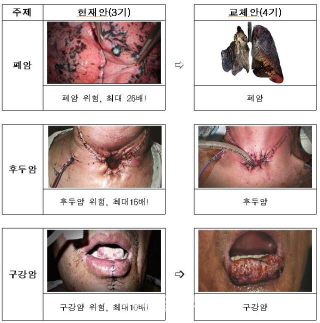 보건복지부가 20일 확정한 ‘4기 담뱃갑 경고 그림 및 문구’. 왼쪽은 현행 3기 그림, 문구이며 오른쪽은 12월 23일부터 바뀌는 4기 그림, 문구다. (사진=보건복지부)