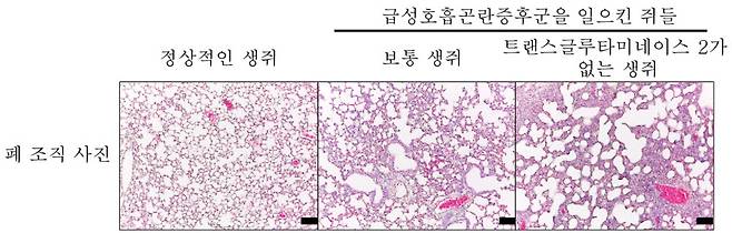 폐 호중구가 폐 염증 질환에서 조직 손상에 끼치는 영향. 사진= 배외식 성균관대 교수