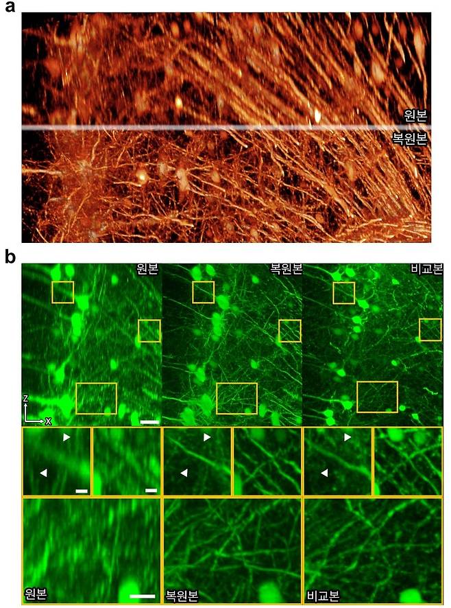 공초점 형광 현미경 영상 3차원 고화질 복원.(KAIST 제공)© 뉴스1