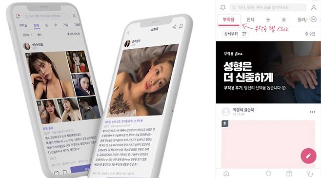 500만 회원을 자랑하는 바비톡은 부작용 후기도 적극 게시해 과장 광고 논란을 비켜 가고 있다. (바비톡 제공)