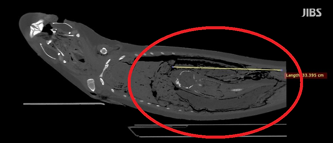 상괭이 사체 CT촬영 결과 확인된 새끼의 모습
