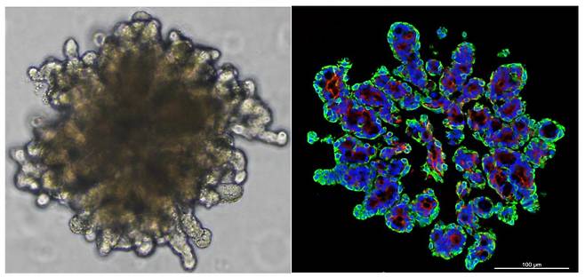 연구진이 침샘 상피줄기세포를 활용해 배양에 성공한 3차원 오가노이드