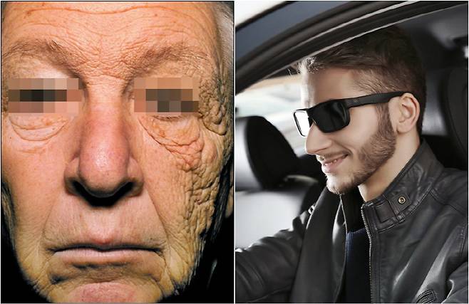 태양에 노출된 얼굴 왼쪽 부분에 심한 노화 현상이 발생한 운전자(왼쪽), 스마트 선글라스 착용 장면 [사진출처=뉴 잉글랜드 저널 오브 메디슨, 이노션]