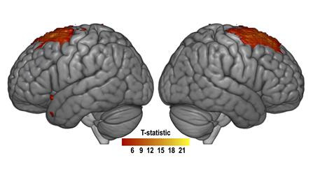 데이터 기반(Data-driven) 신경학적 연결망 지도. 연구팀은 어떠한 가설 없이 데이터만을 가지고 신경학적 연결망을 조사하였을 때, 상전두회를 중심으로한 신경학적 연결망이 통계적 학습에 크게 기여하고 있음을 밝혀냈다. [사진=DGIST]